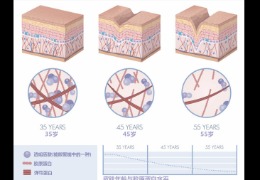 都在問(wèn)的乙酰殼糖胺（NAG）功效怎么樣？功效成分的護膚品應該怎么選？